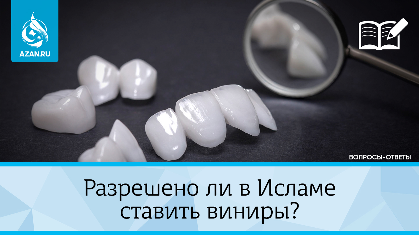 Разрешено ли в Исламе ставить виниры?