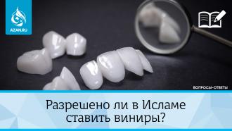Разрешено ли в Исламе ставить виниры?